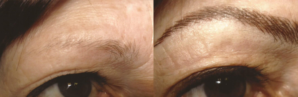 Before And After Images Of Permanent Eye Brows