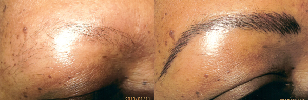 Before And After Images Of Permanent Eye Brows