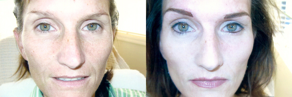 Before And After Images Of Full Face Permanent Makeup