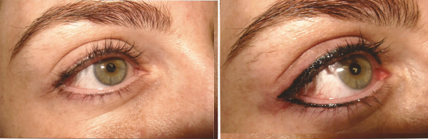 Before And After Images Of Permanent Eyeliner