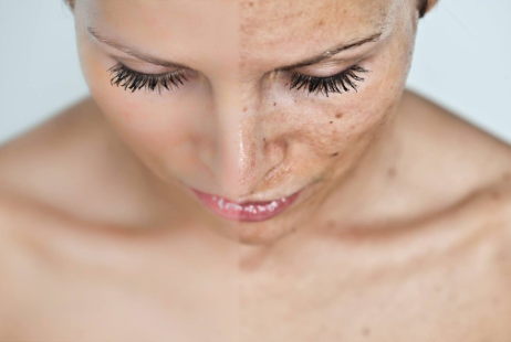Permanent Makeup for Scar Camouflage: Transformative Techniques